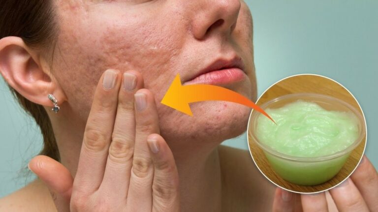 erva para alergia na pele