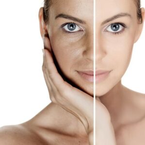 erva para alergia na pele