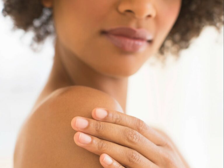 ervas medicinais para pele