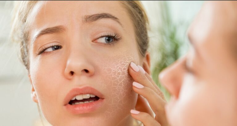 ervas medicinais para pele