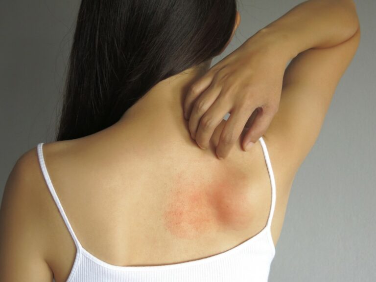 ervas medicinais para pele