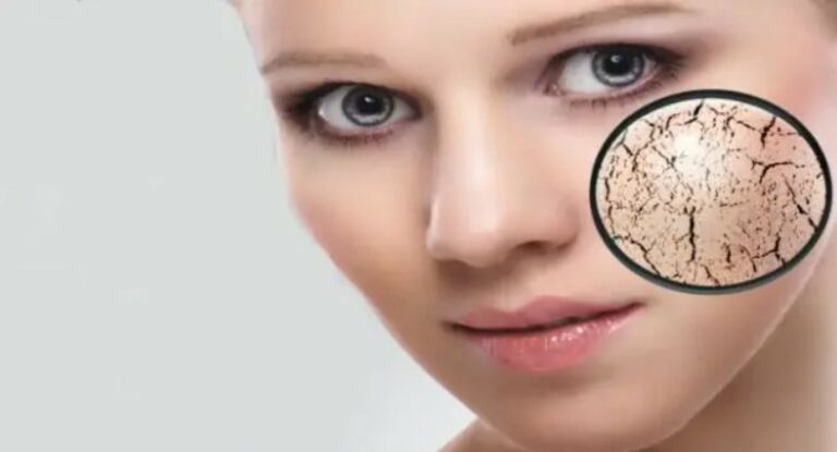 ervas para pele seca