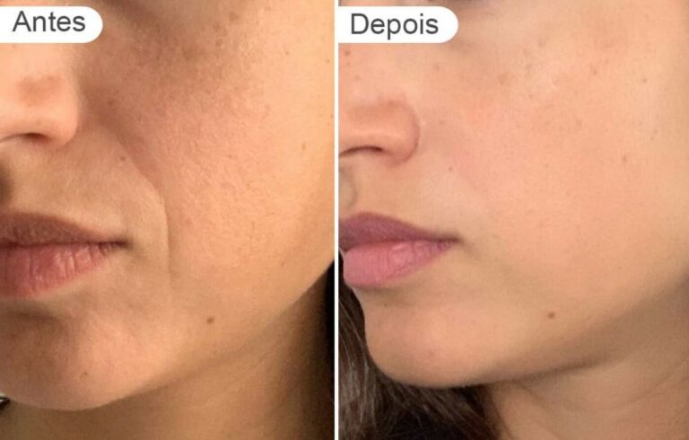 ervas para pele seca