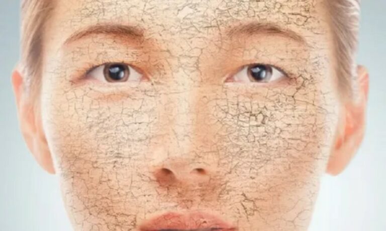 ervas para pele seca